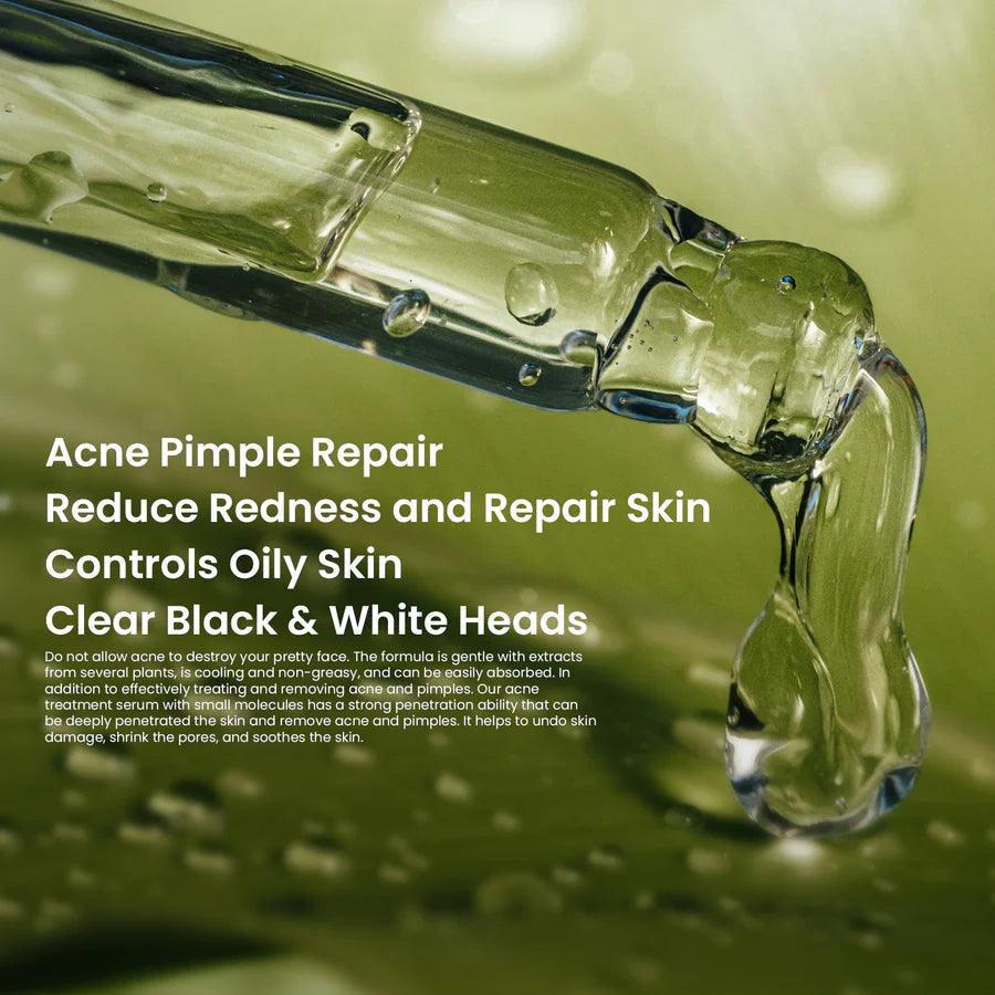 Rivaj Acne Treatment Serum - 30ml Rivaj
