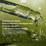 Rivaj Acne Treatment Serum - 30ml