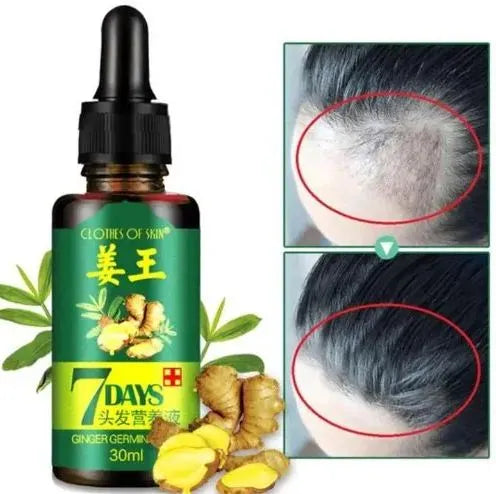 Aichun Beauty 7 Days Ginger Hair Growth Oil Serum For Damaged Hair Aichun Beauty