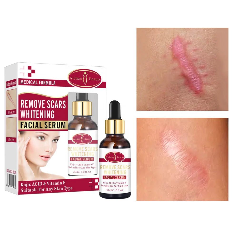 Aichun Beauty Remove Scars Whitening Facial Serum 30 ML Aichun Beauty