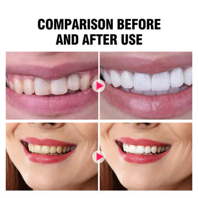 Aichun Beauty Teeth Coconut Black Bamboo Charcoal Toothpaste - 100g Aichun Beauty