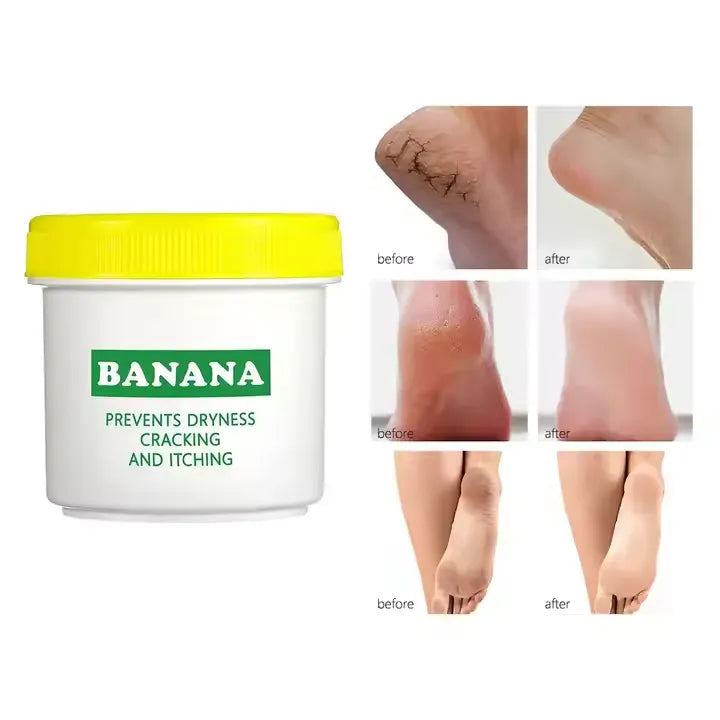 Aichun Beauty Organic Banana Extract Foot Cream Aichun Beauty