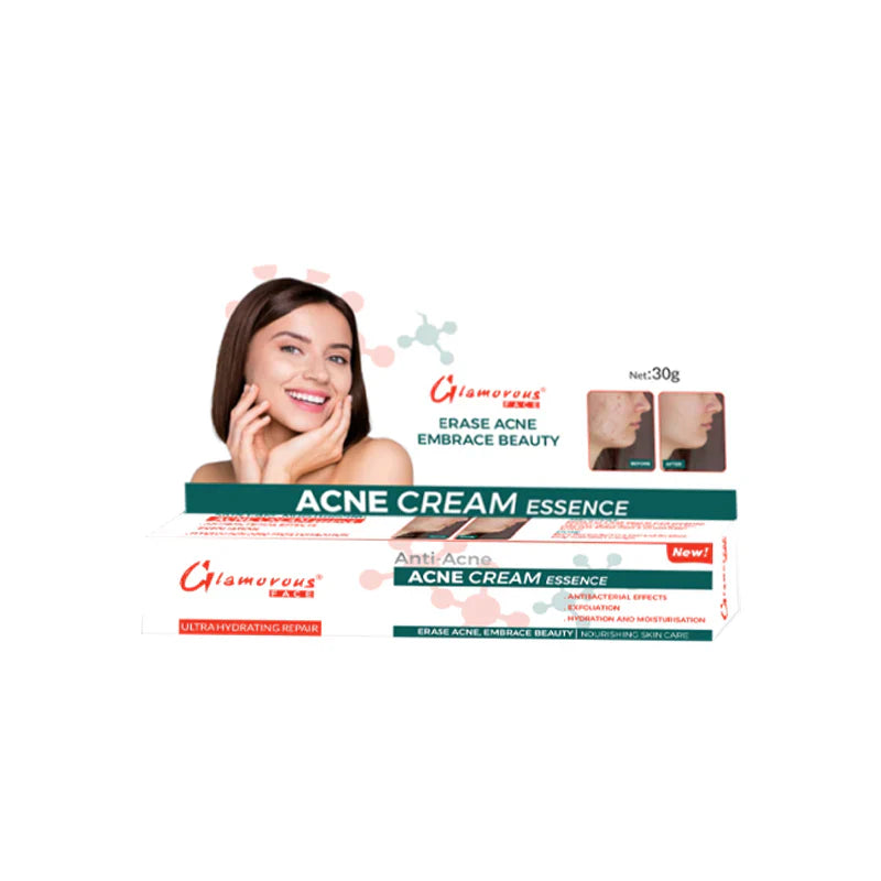 Glamorous Face Anti Acne Cream Glamorous Face