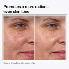 Urapra Glycolic Acid 7% Toning Solution - 100ml Urapra