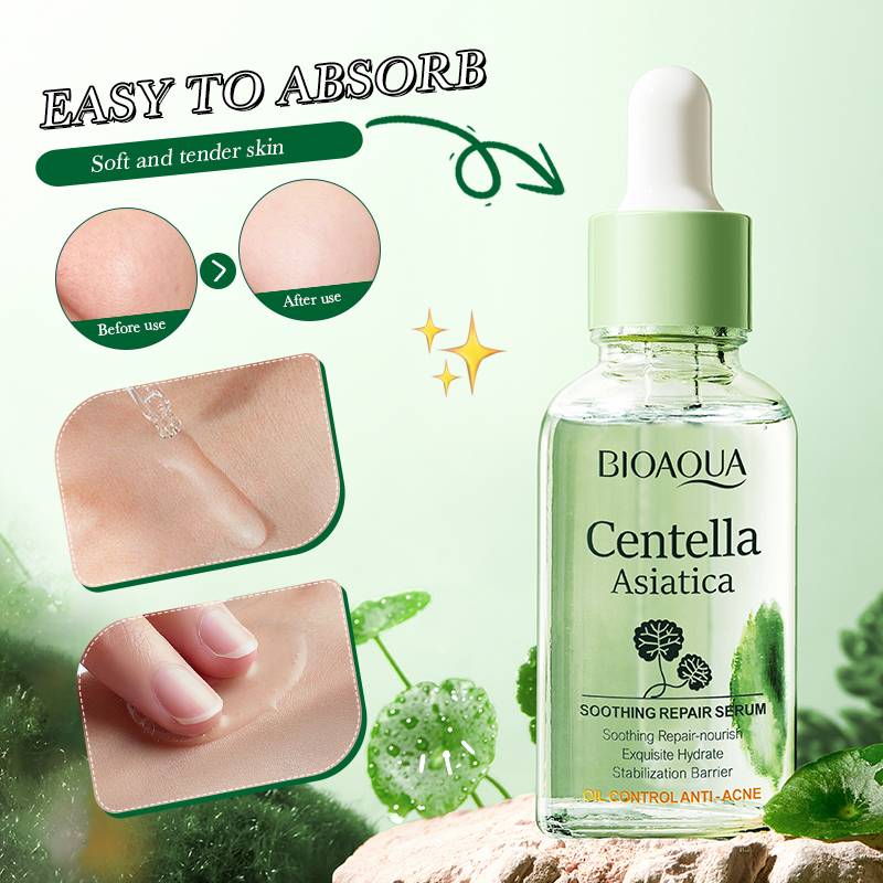 Bioaqua Centella Asiatica Soothing Repair Anti Acne Face Serum Essence - 30ml Bioaqua