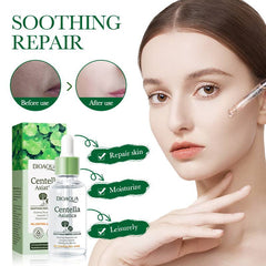 Bioaqua Centella Asiatica Soothing Repair Anti Acne Face Serum Essence - 30ml Bioaqua