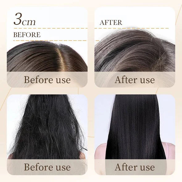 Bioaqua Rice Raw Pulp Removal Dandruff Shampoo - 500ml Bioaqua