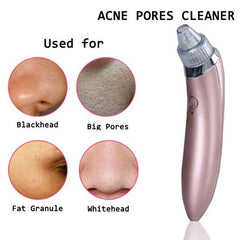 Electric Blackheads Remover Beauty Tool Cosmia.pk