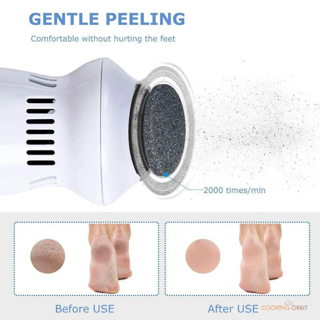 Callus Remover With Built-In Vacuum Electric Foot Grinder Cosmia.pk