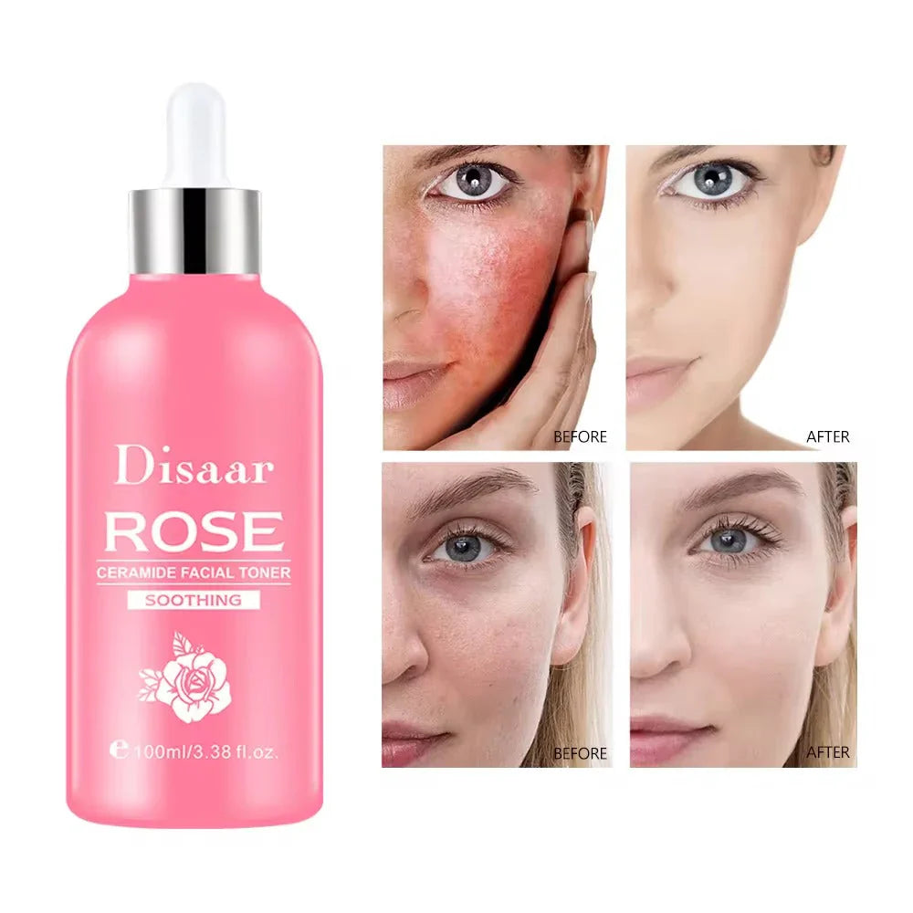 DISAAR Rose Ceramide Soothing Facial Toner - 100ml DISAAR