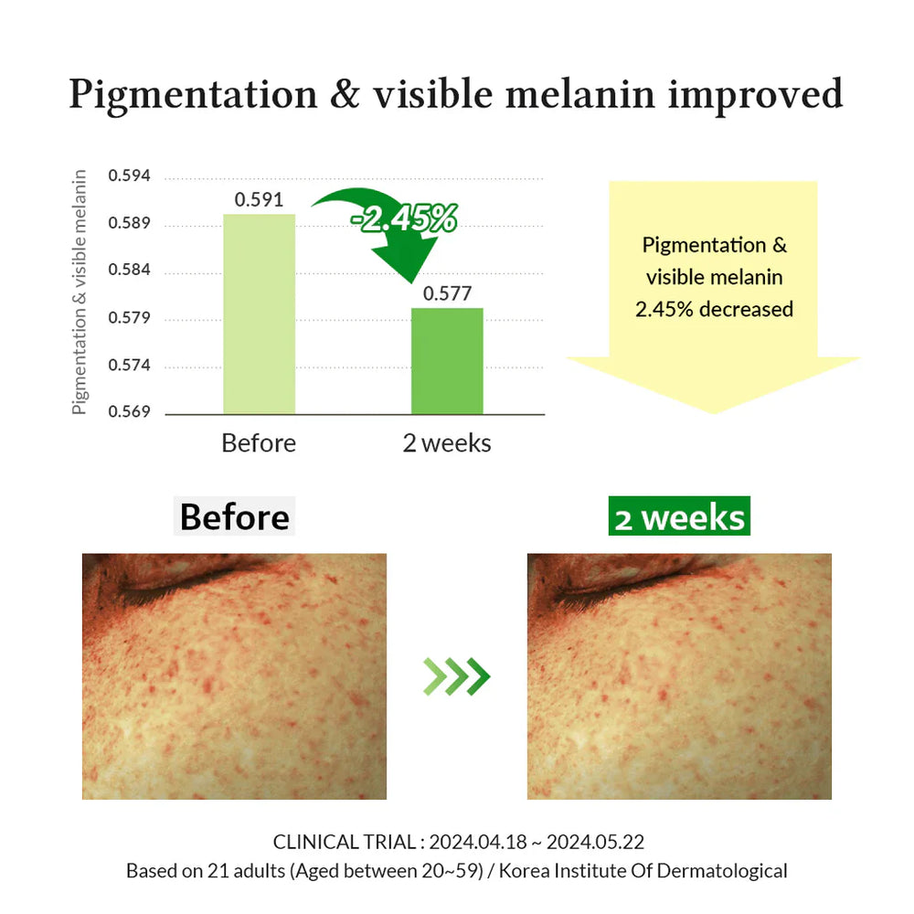 Dr.Althea Gentle Vitamin C Serum - 30ml Dr Althea