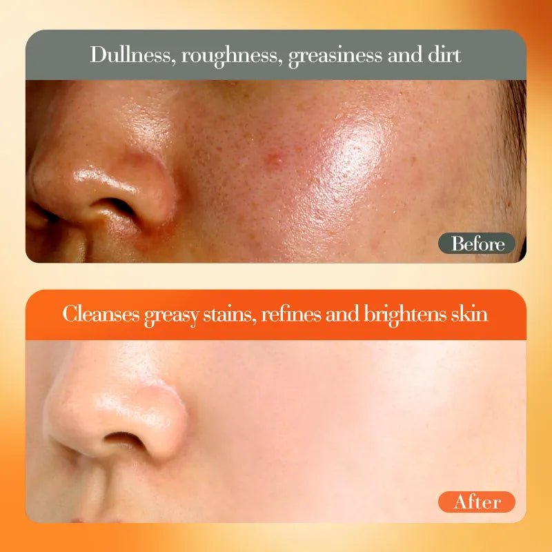 FAYANKOU Whitening Brightens Vitamin C Essence Cream - 50g FAYANKOU