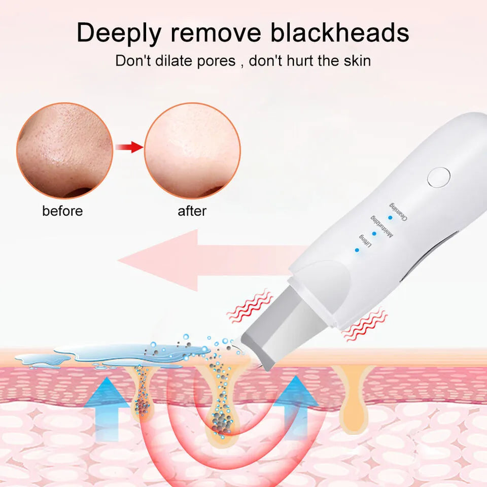 Face Scrubber Machine For Blackhead Cosmia.pk