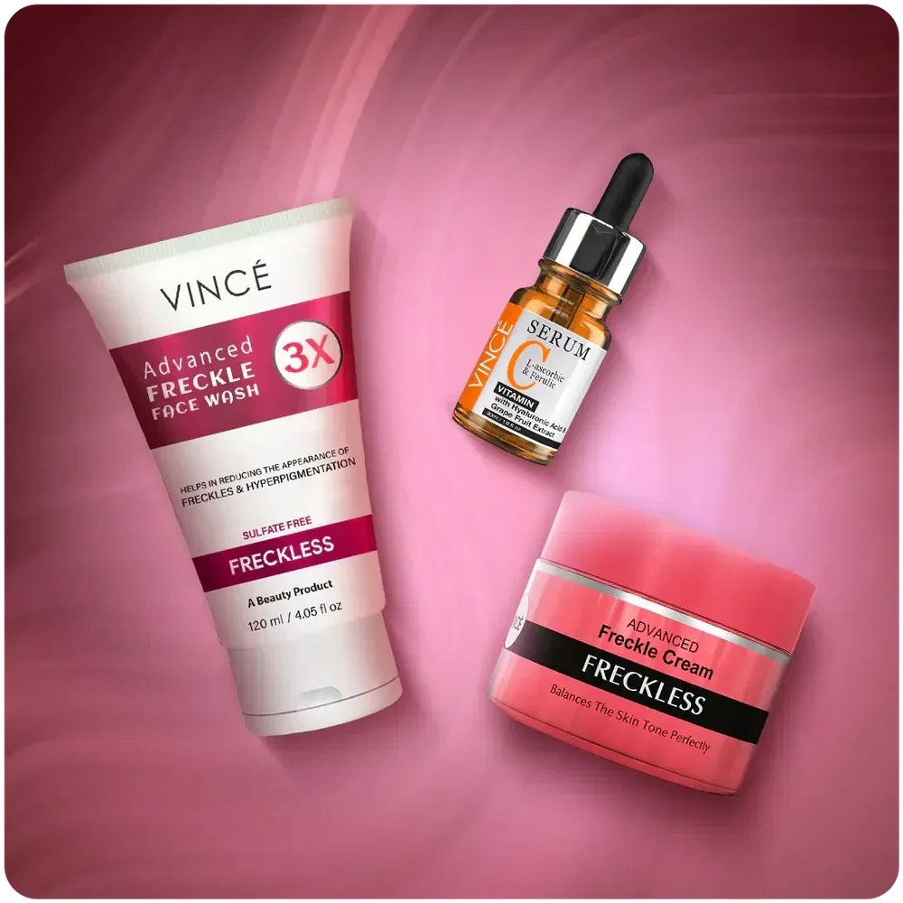 Vince Freckle Challenge Kit Vince