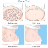 Guanjing Remove Stretch Marks Cream Anti-Wrinkle Maternity Skin Repair - 80g