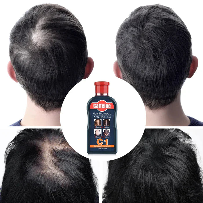 Pei Mei Caffeine Hair Shampoo Anti-Hair Loss - 200ml Pei Mei