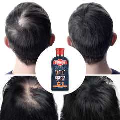 Pei Mei Caffeine Hair Shampoo Anti-Hair Loss - 200ml Pei Mei