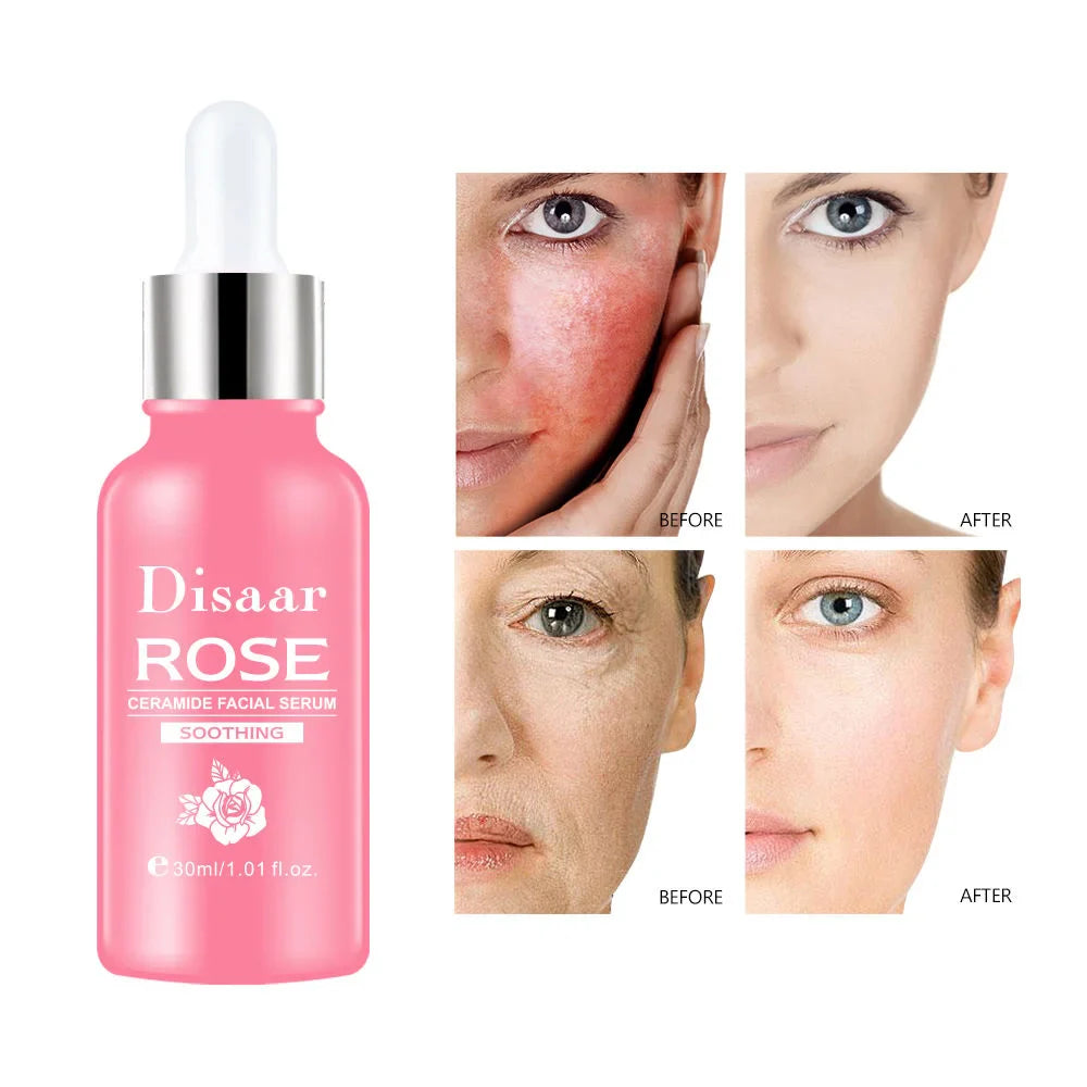 DISAAR Rose & Ceramide Soothing Facial Serum - 30ml Disaar