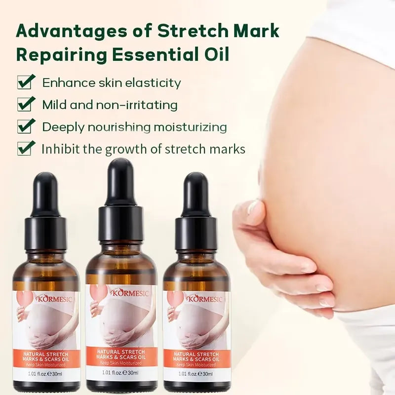 KORMESIC Skincare for Natural Belly Care Remover Stretch Mark Oil - 100ml KORMESIC