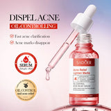 Sadoer Acne Relief Face Serum - 30ml