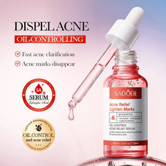 Sadoer Acne Relief Face Serum - 30ml Sadoer