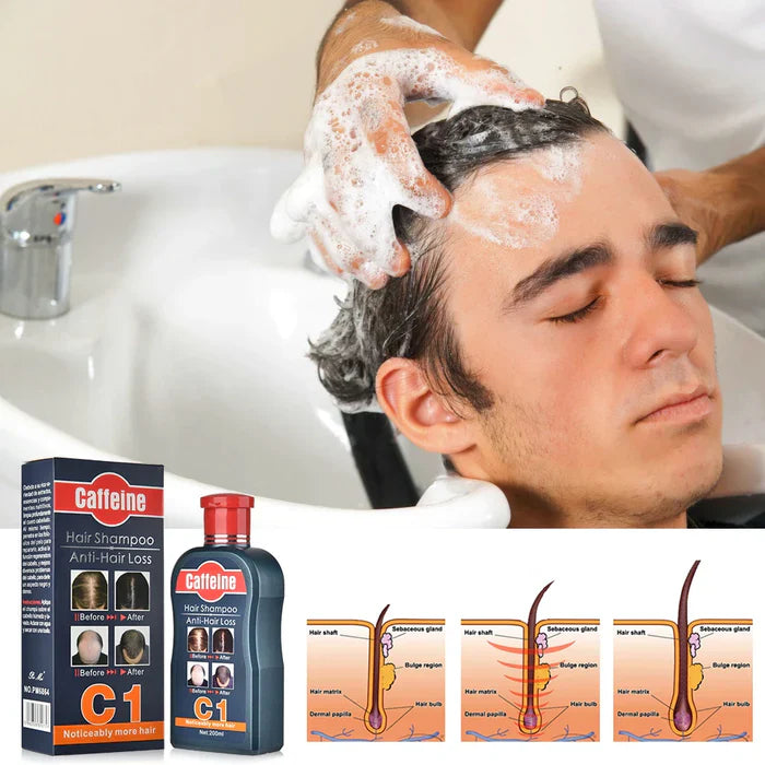 Pei Mei Caffeine Hair Shampoo Anti-Hair Loss - 200ml Pei Mei