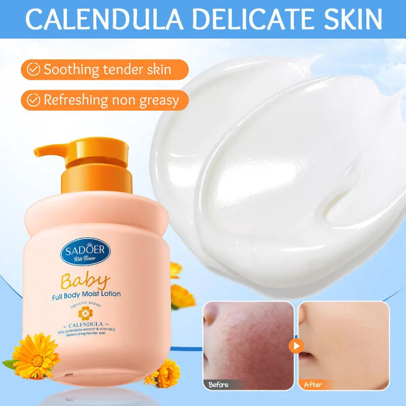 Sadoer Calendula Amino Acid Formula Baby Moist Lotion – 400 ml Sadoer