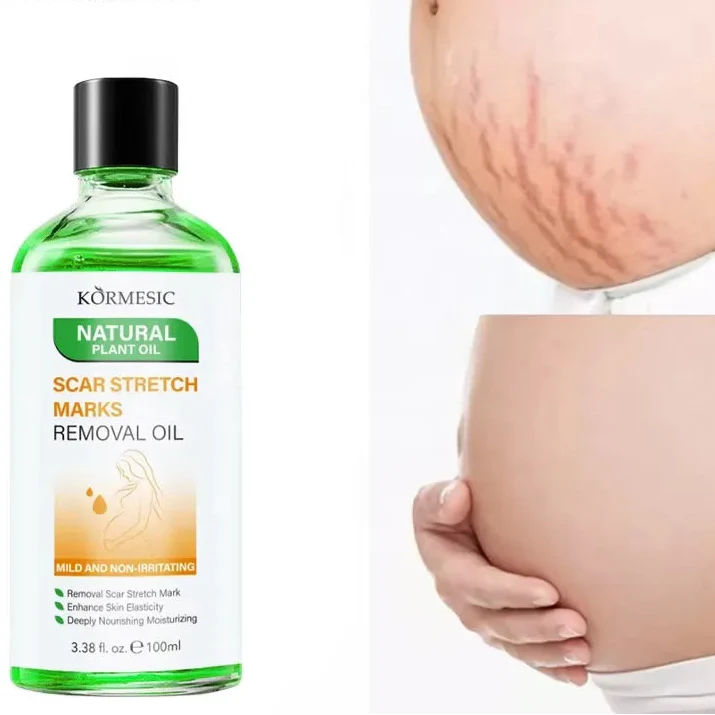 KORMESIC Skincare for Scratches Oil Marks Removal extra Virgin Mark - 100ml KORMESIC