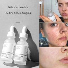 The Ordinary Hyaluronic Acid 2% + B5 Serum  - 30ml The Ordinary