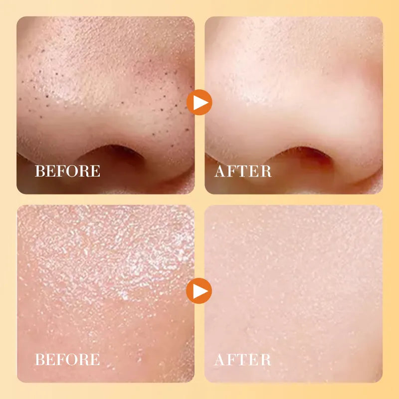 Sadoer Vitamin C Brightening Exfoliator Gel 140g Sadoer