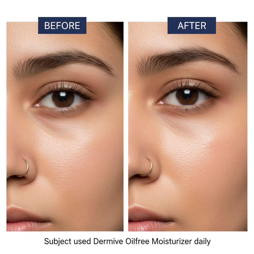 Jenpharm Dermive Oil Free Moisturizer Spf 20 - 100ml - Factory Jenpharm