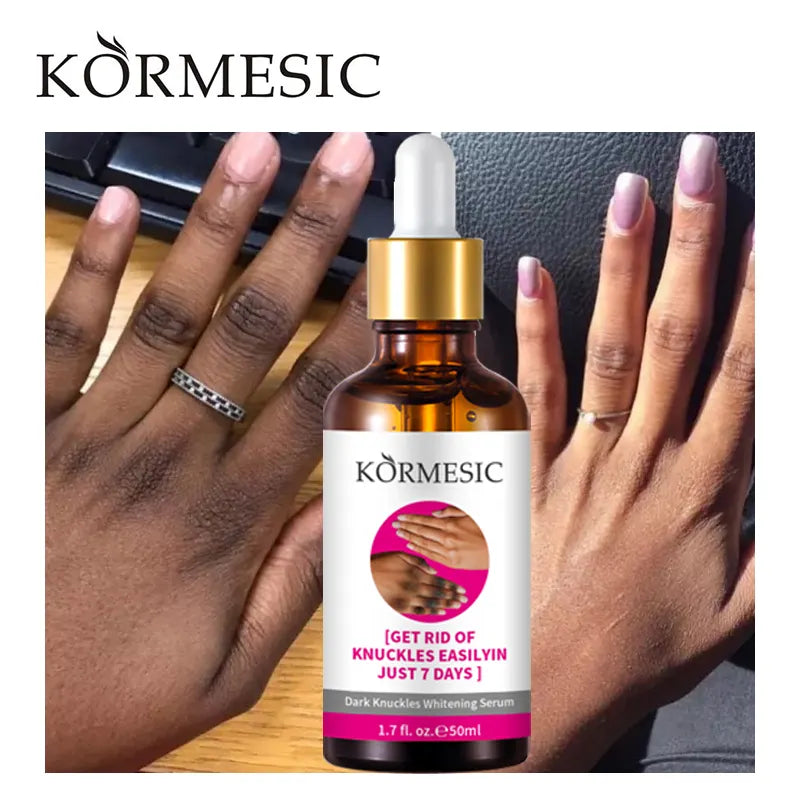 Kormesic Hand Dark Knuckle Whitening Brightening Serum - 50ml Kormesic