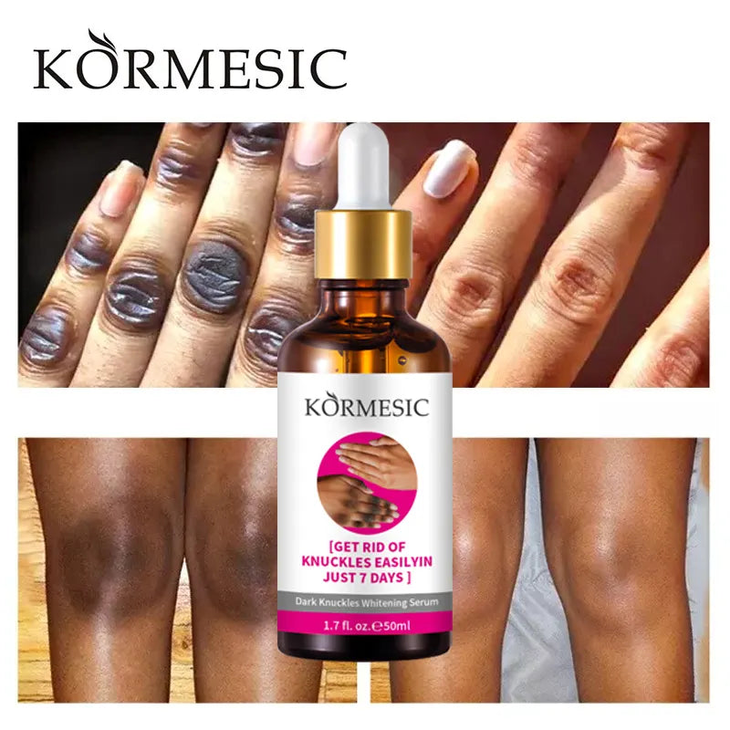 Kormesic Hand Dark Knuckle Whitening Brightening Serum - 50ml Kormesic