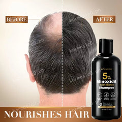 KORMESIC Minoxidil with Biotin Hair Grower Shampoo - 300ml KORMESIC