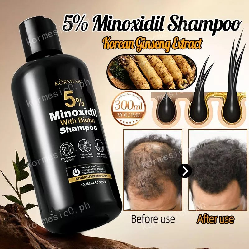 KORMESIC Minoxidil with Biotin Hair Grower Shampoo - 300ml KORMESIC
