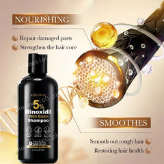 KORMESIC Minoxidil with Biotin Hair Grower Shampoo - 300ml KORMESIC