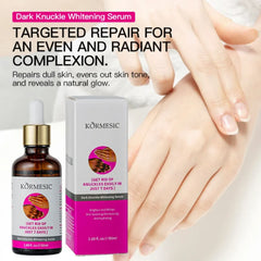Kormesic Hand Dark Knuckle Whitening Brightening Serum - 50ml Kormesic