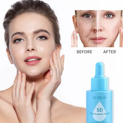 ESTELIN 5D Hyaluronic Acid Hydrating Face Serum - 30ml Estelin