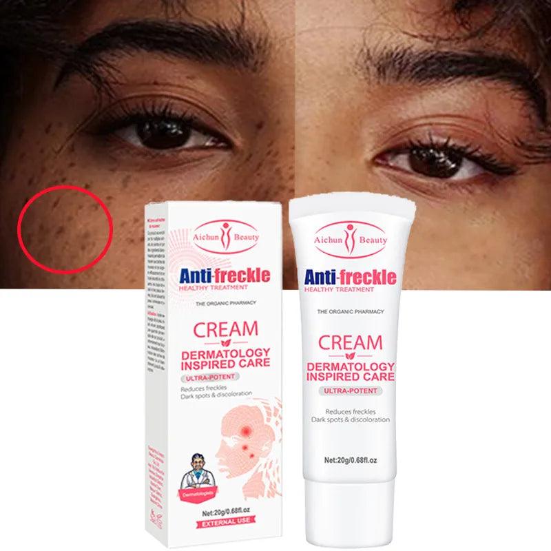 Aichun Beauty Remove Freckles Dark Spots Anti-Freckle Cream Aichun Beauty