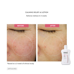 Physiogel Calming Relief A.i Lotion 200ml Physiogel