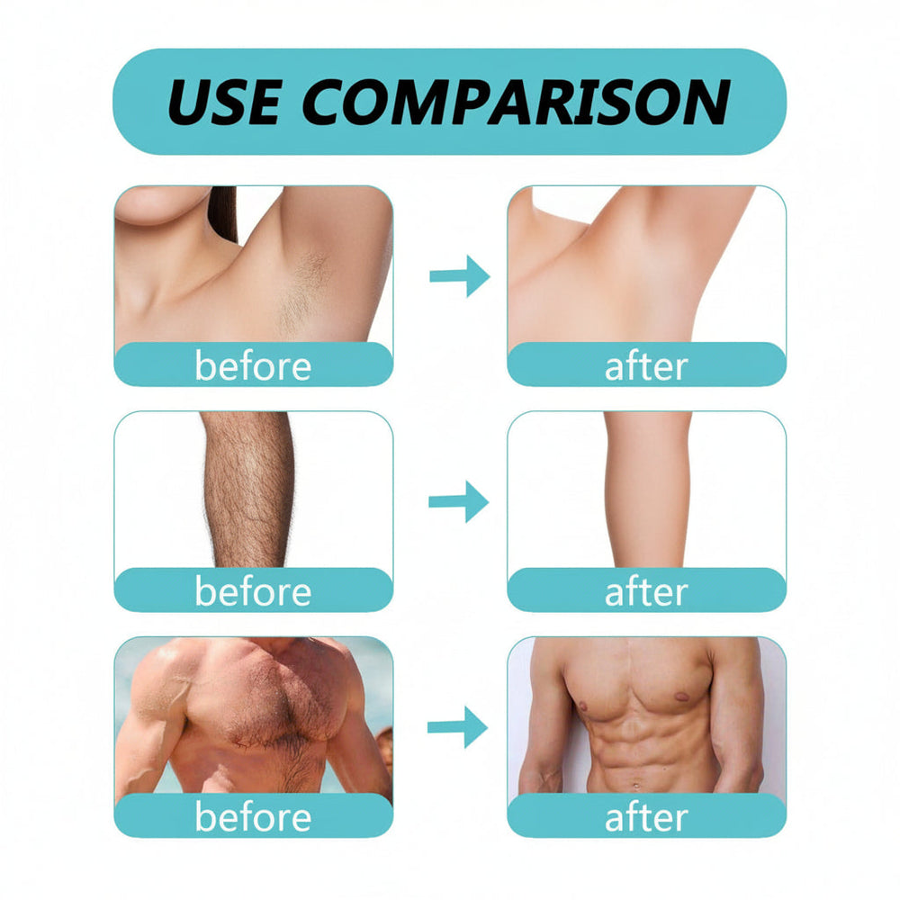 Ecrin Hair Removal Spray Ecrin