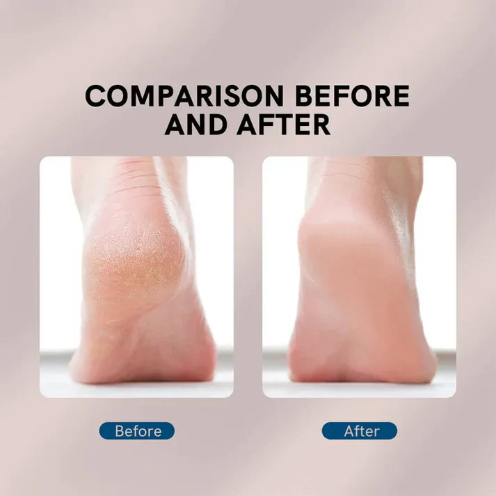 Flawless Electric Foot Callus Remover Cosmia.pk