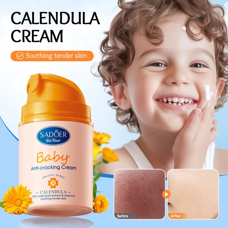 SADOER Baby Calendula Vitamin E Gentle Soothing Anti-Repair Cream Sadoer