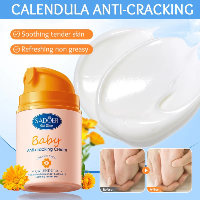 SADOER Baby Calendula Vitamin E Gentle Soothing Anti-Repair Cream Sadoer
