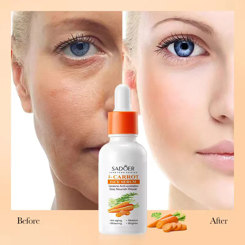 SADOER Carotene Soothing And Repairing B-Carrot Face Serum - 30ml Sadoer