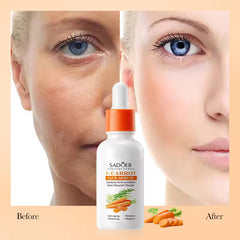 SADOER Carotene Soothing And Repairing B-Carrot Face Serum - 30ml Sadoer