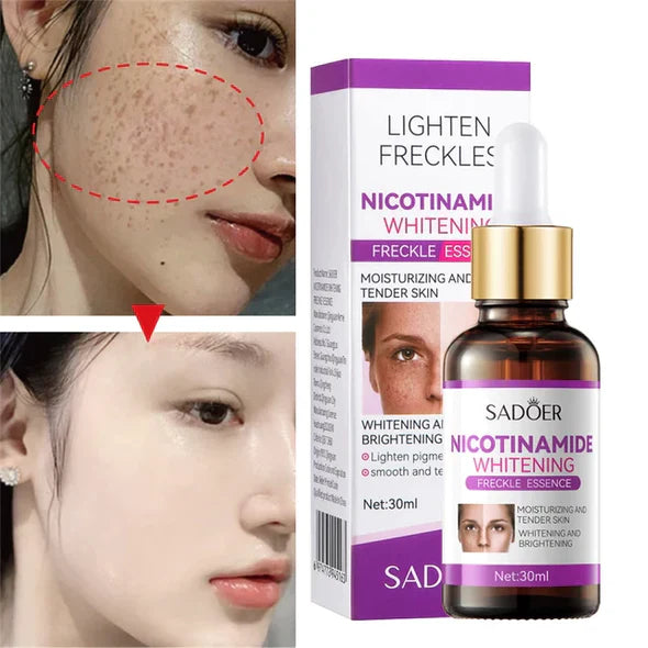 Sadoer Niacinamide Whitening Freckles Serum 30ml Sadoer