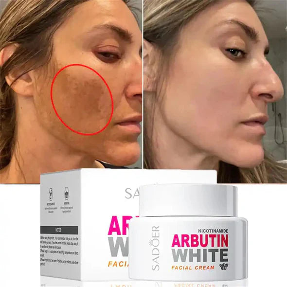 Sadoer Nicotinamide Arbutin White Facial Cream - 50g Sadoer