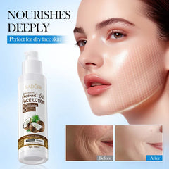 SADOER Nourishing Coconut Oil Moisturize Face Lotion  - 100ml Sadoer