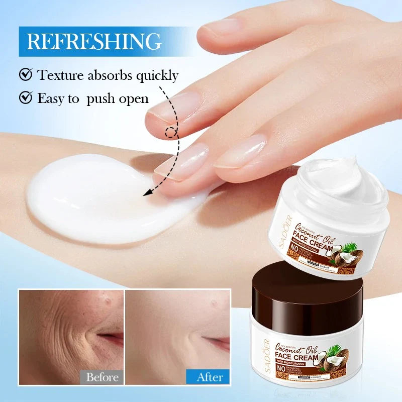 SADOER Nourishing Coconut Oil Moisturizing Face Cream  - 50gm Sadoer